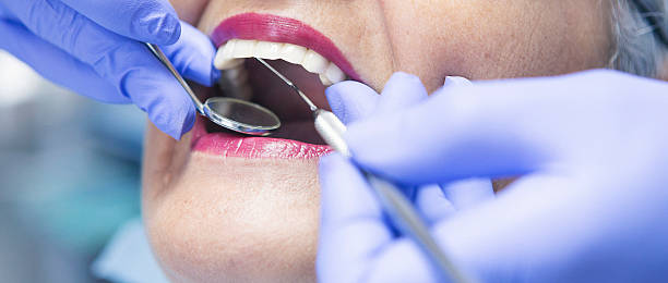 Best Emergency Dental Care for Broken or Chipped Teeth in Lake Brownwood, TX